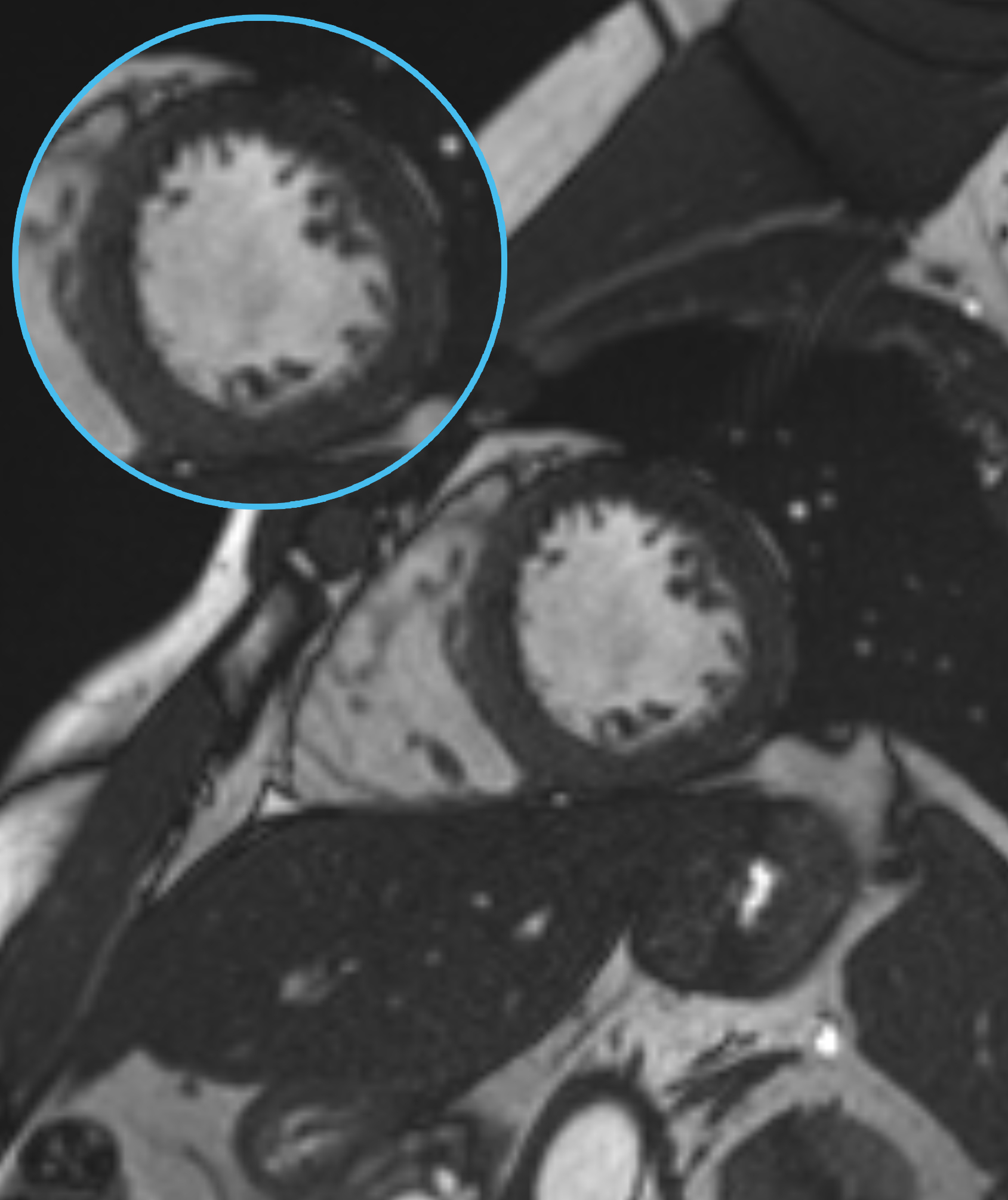 Left Image