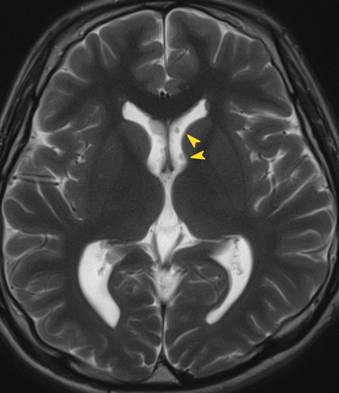 Left Image