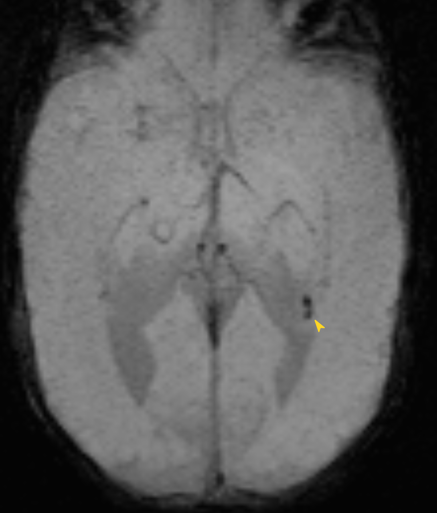 Left Image