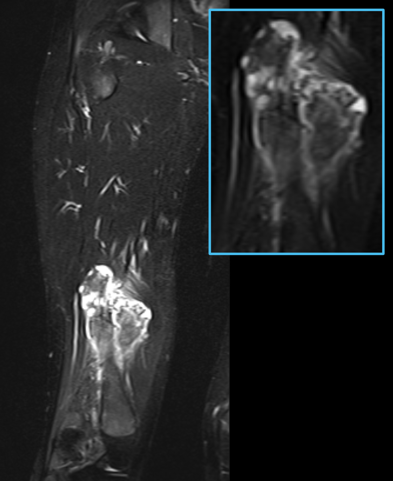 Left Image