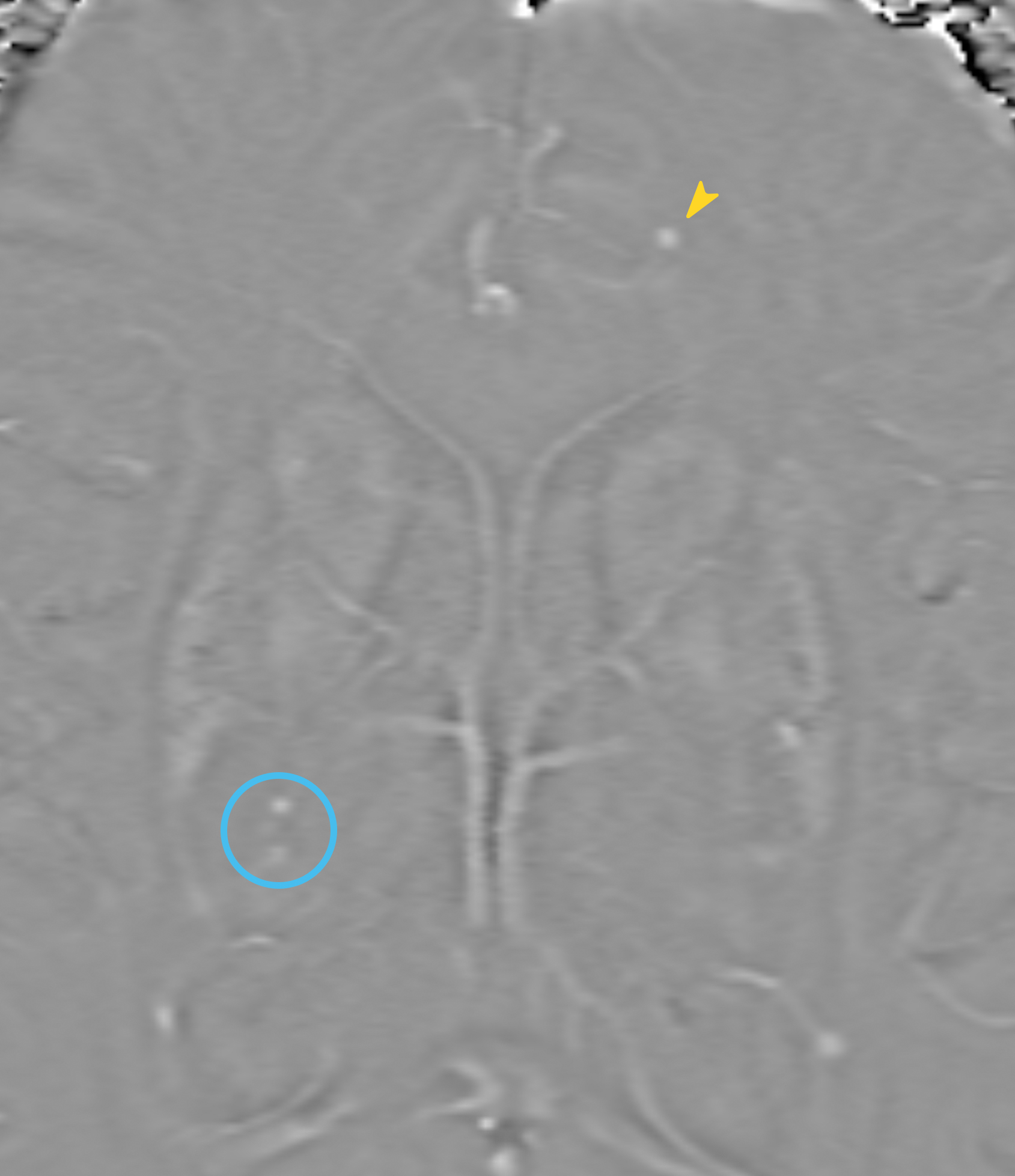 Left Image