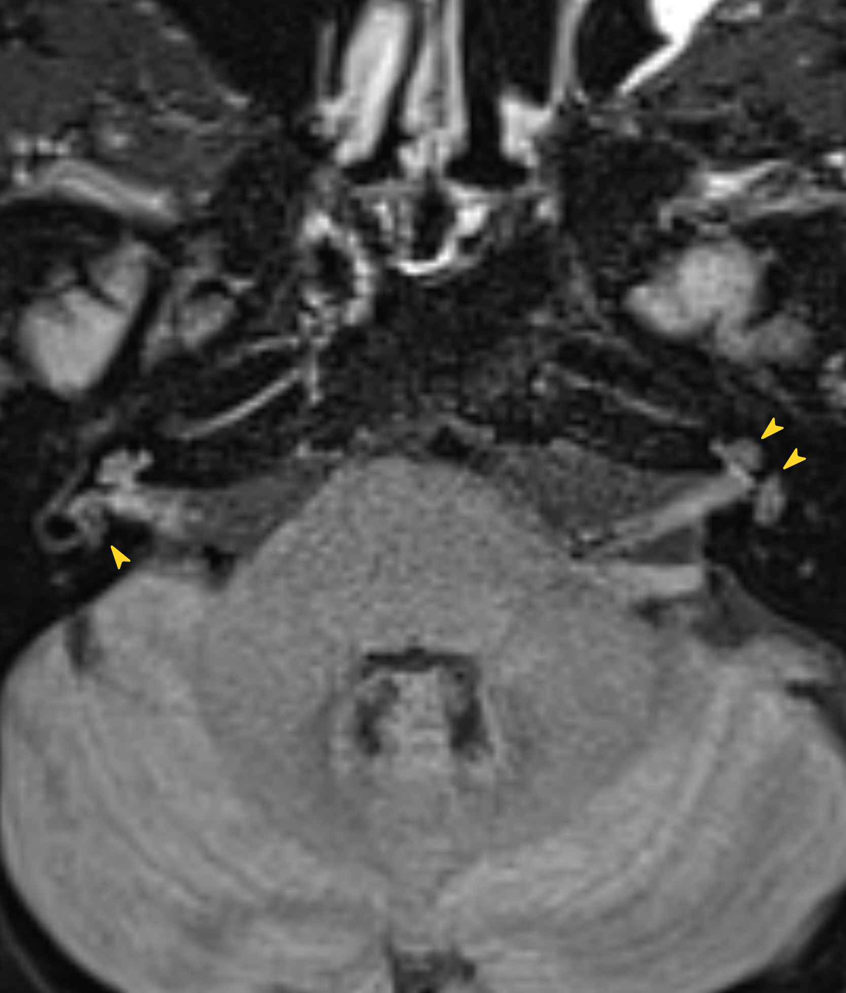 Left Image