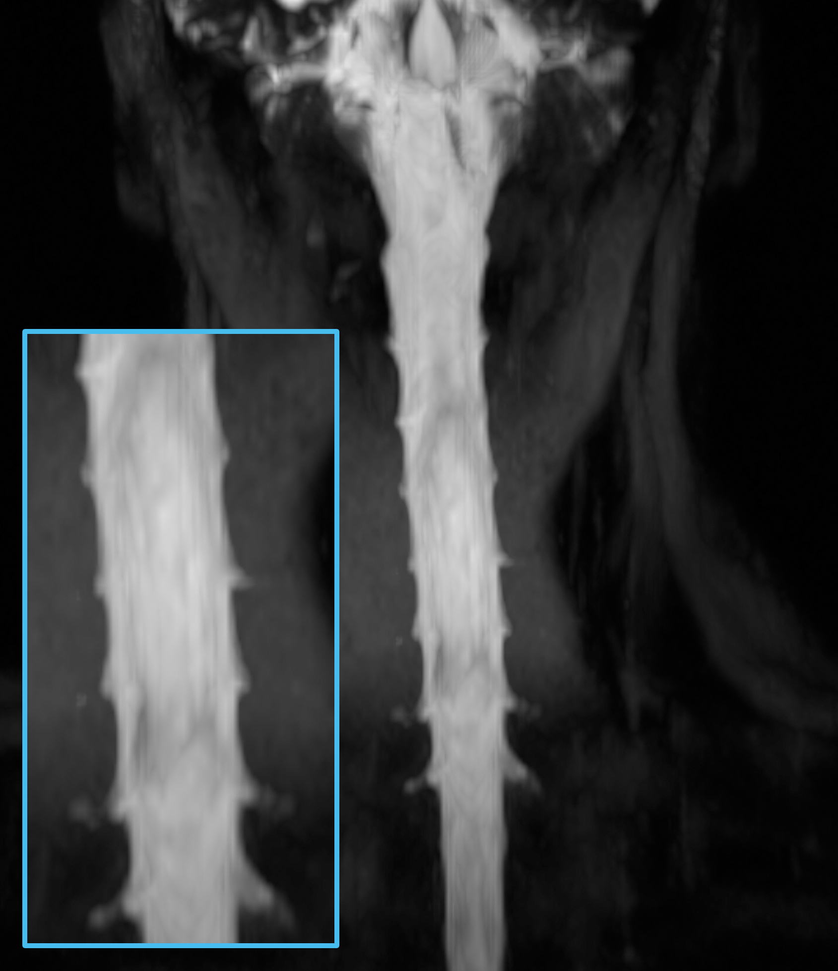 Left Image