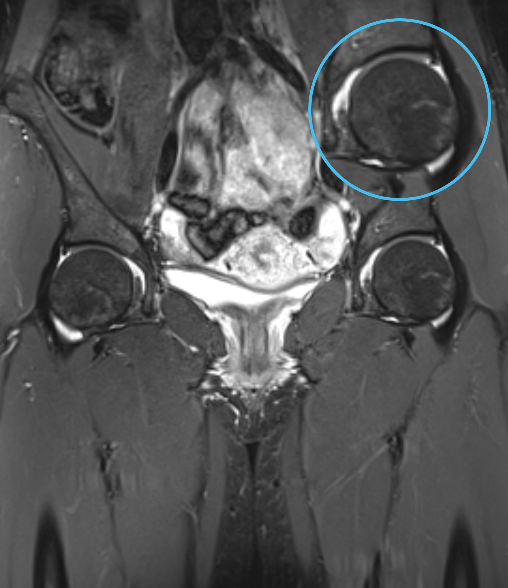 Left Image