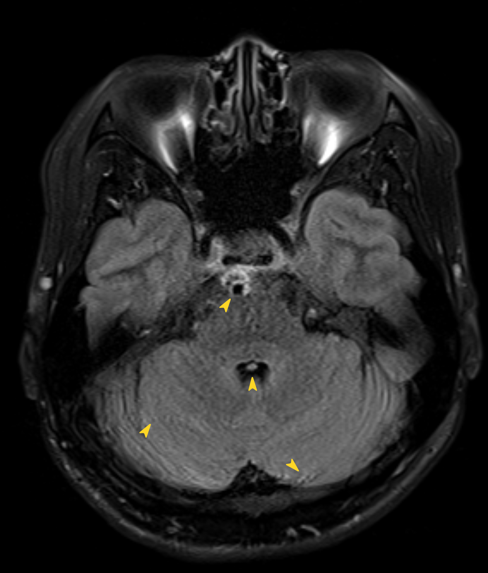 Left Image