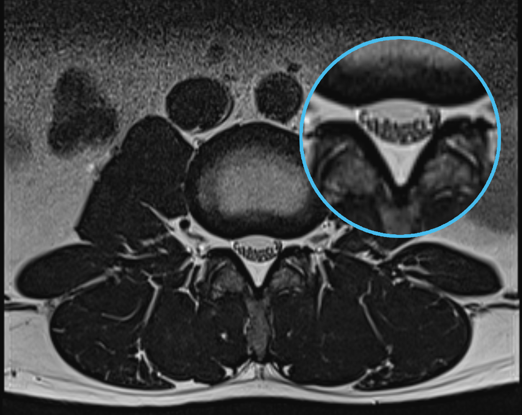 Left Image