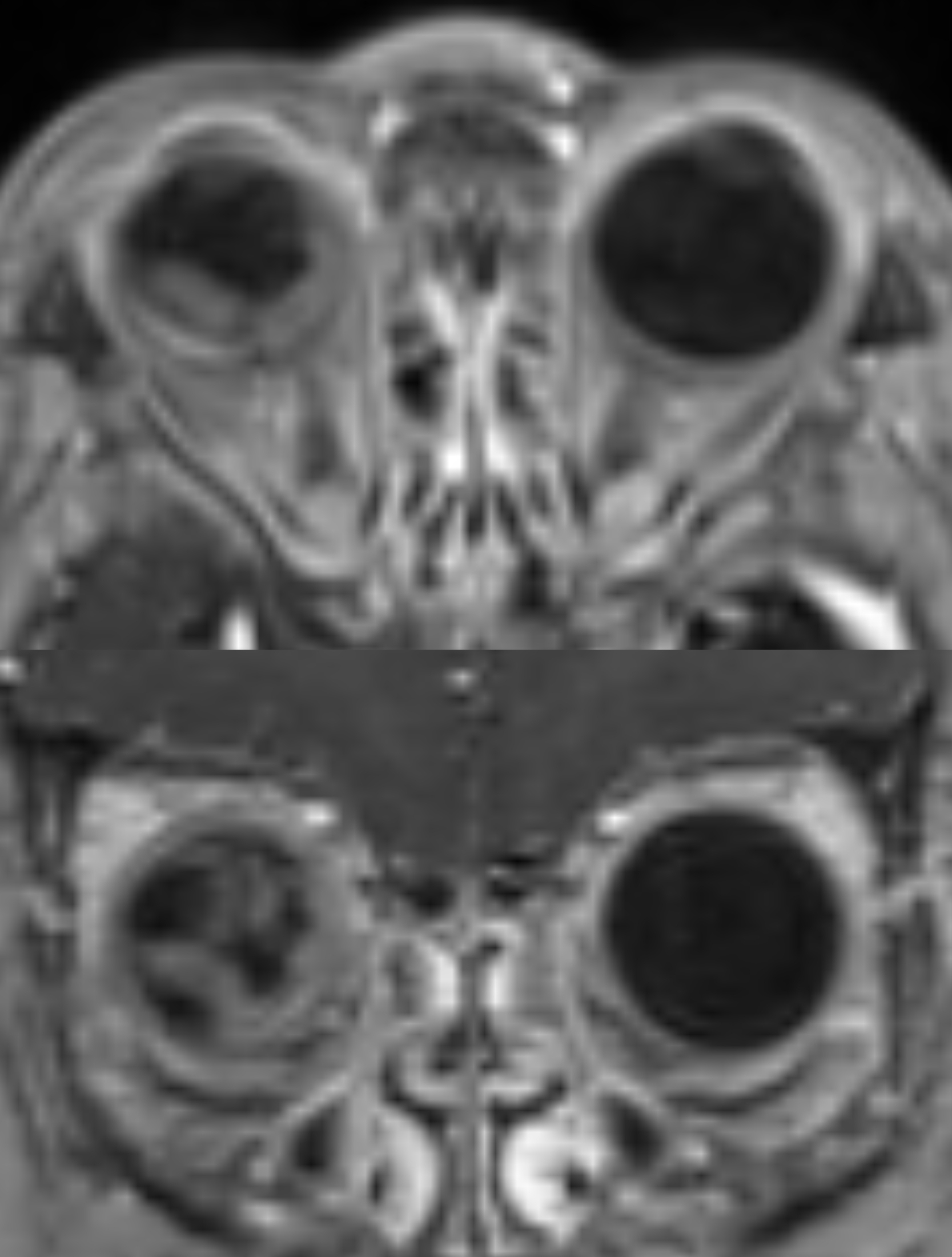 Left Image