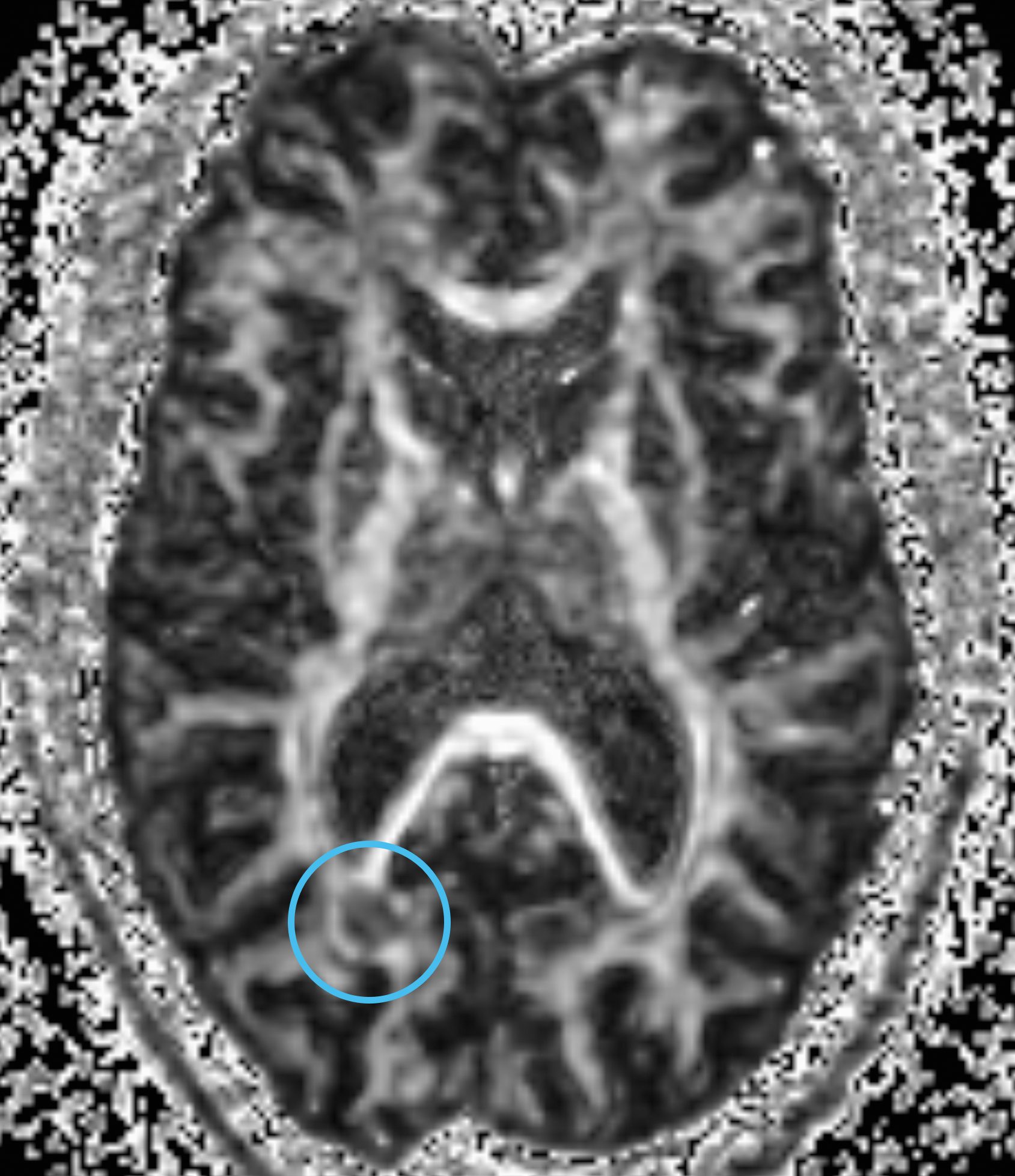 Left Image