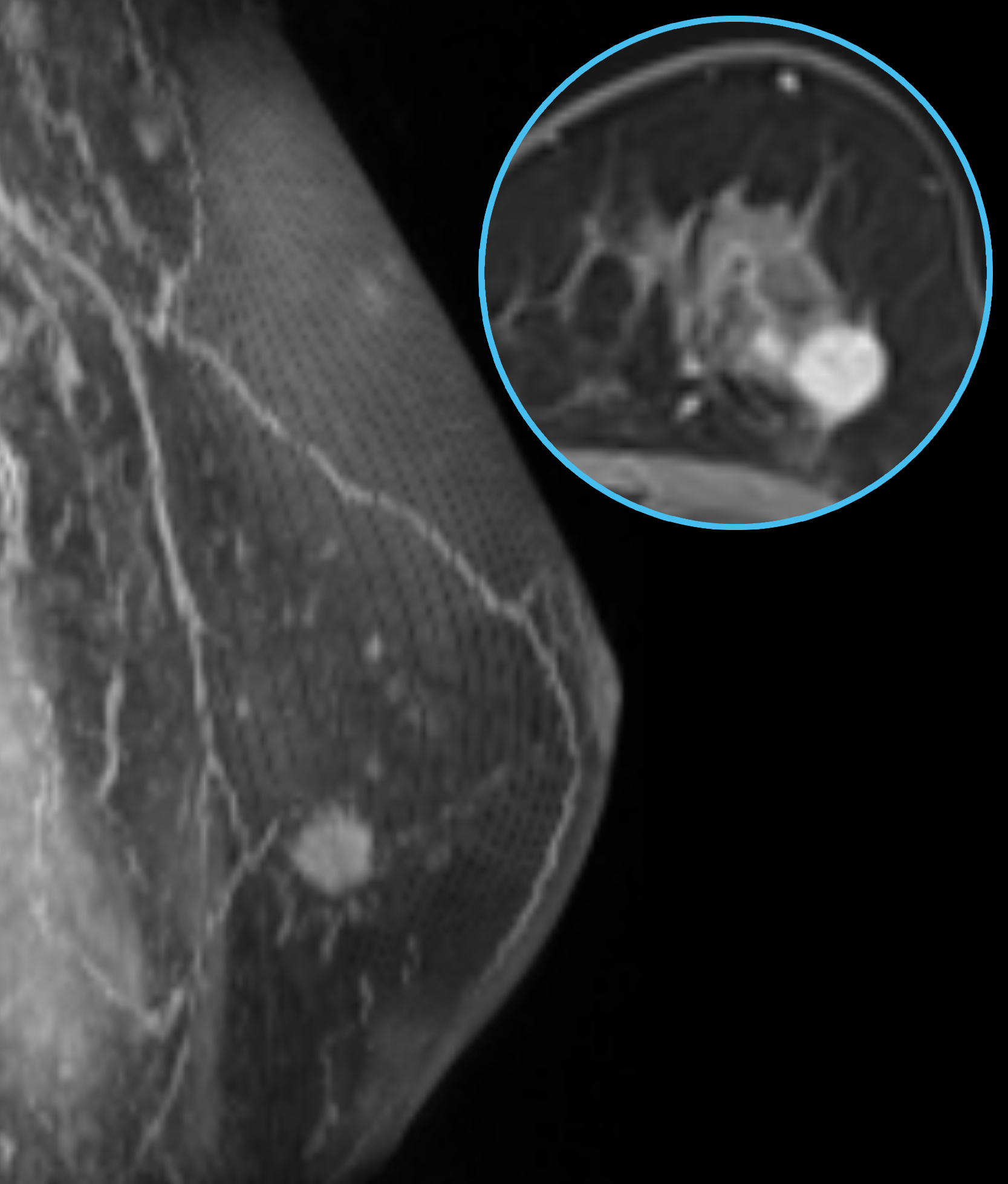 Left Image