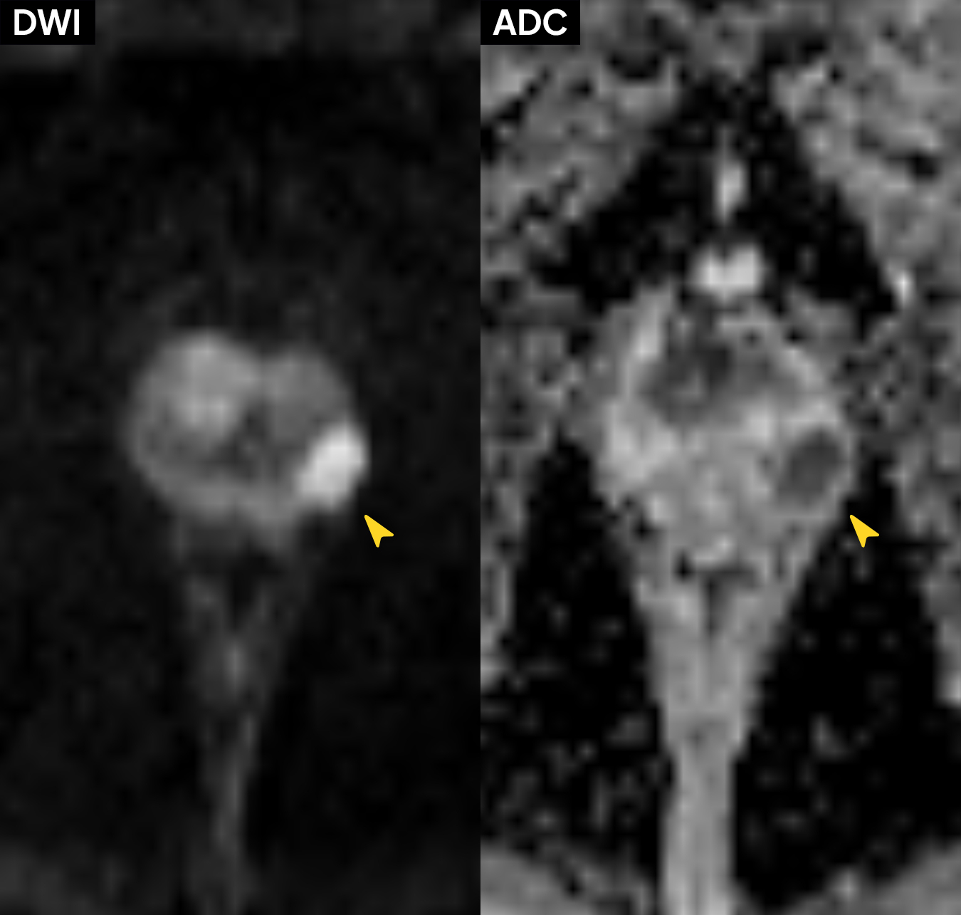 Left Image