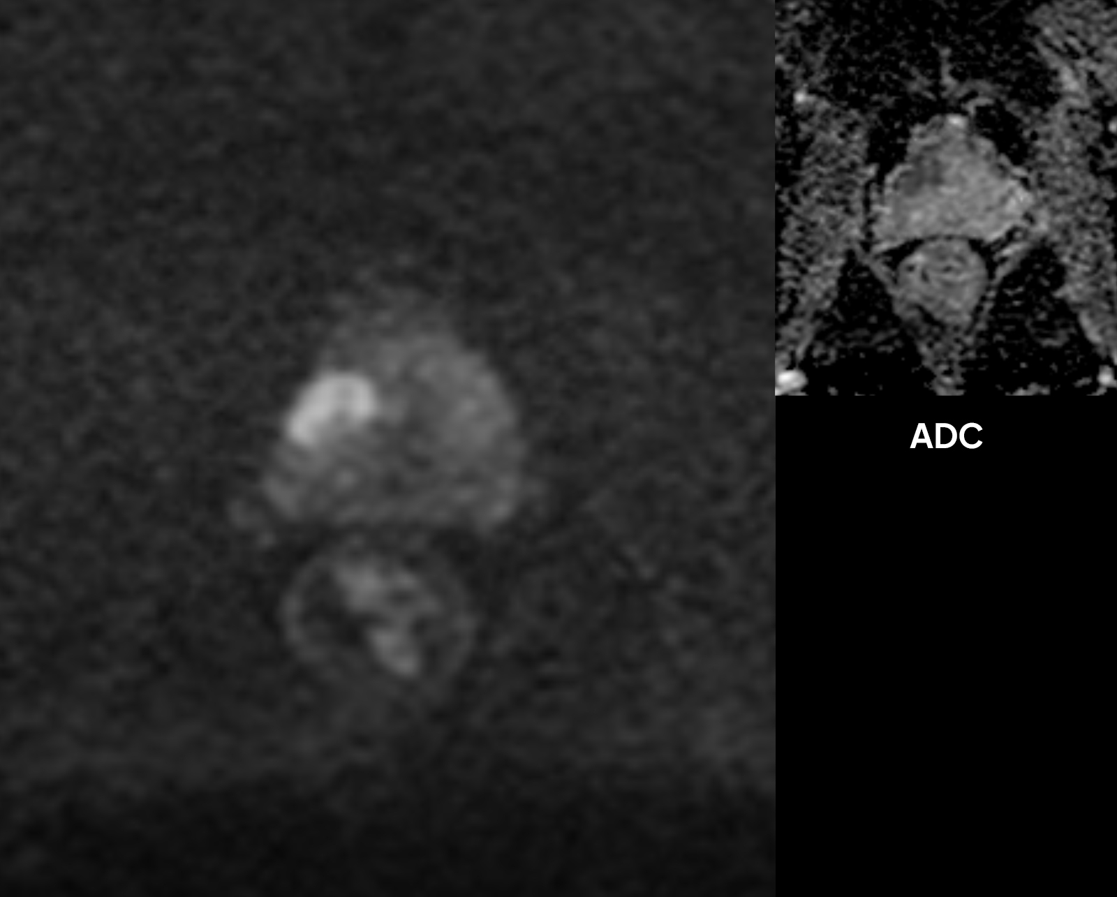 Left Image