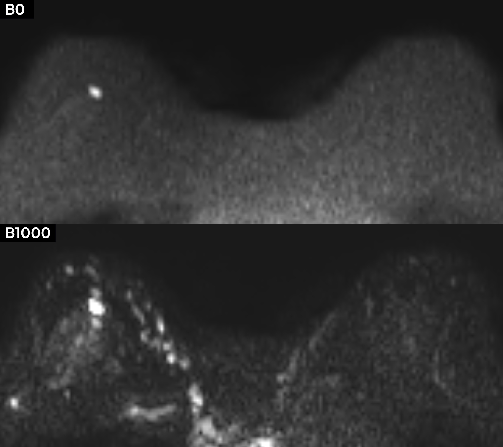 Left Image