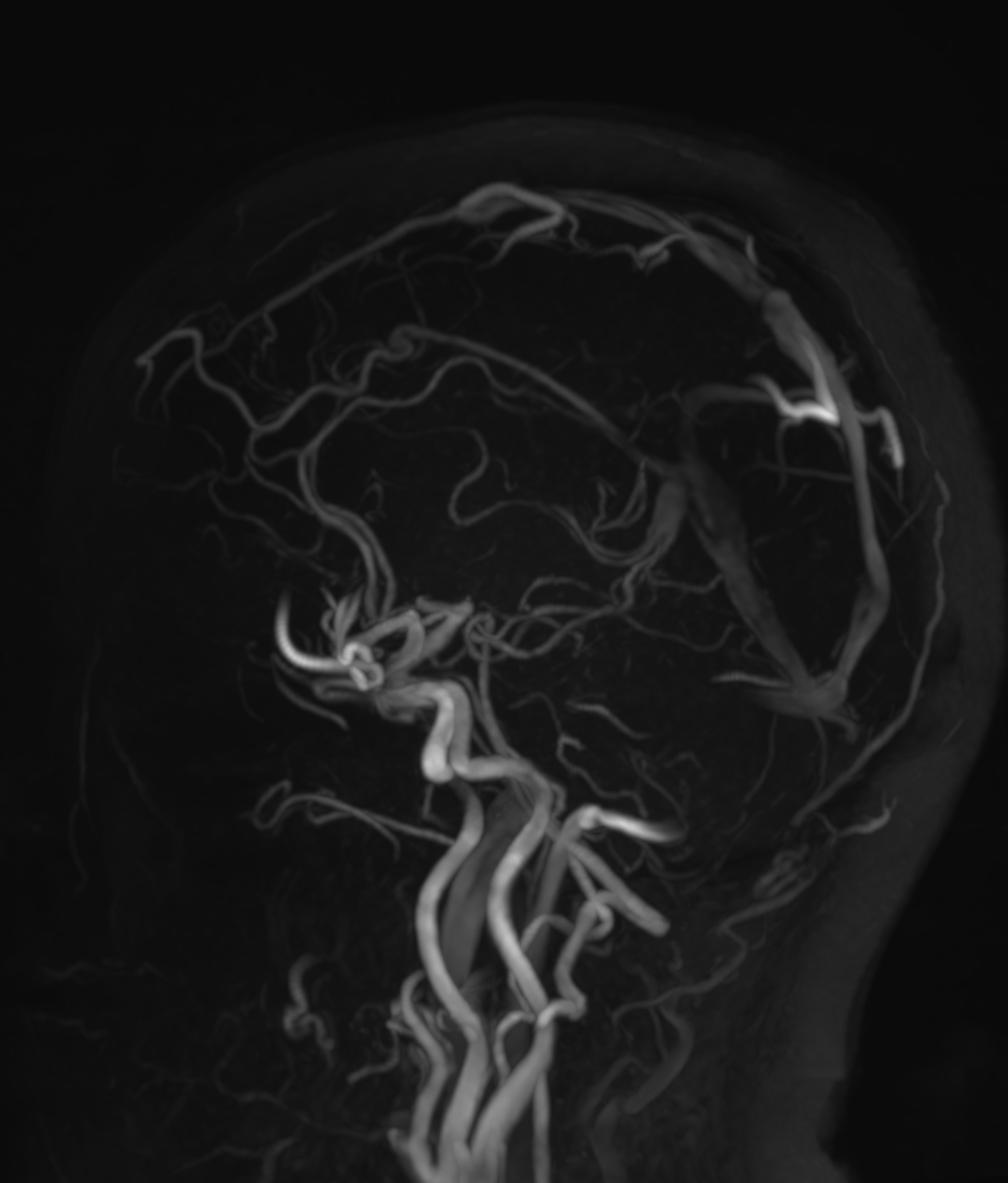 Right Image