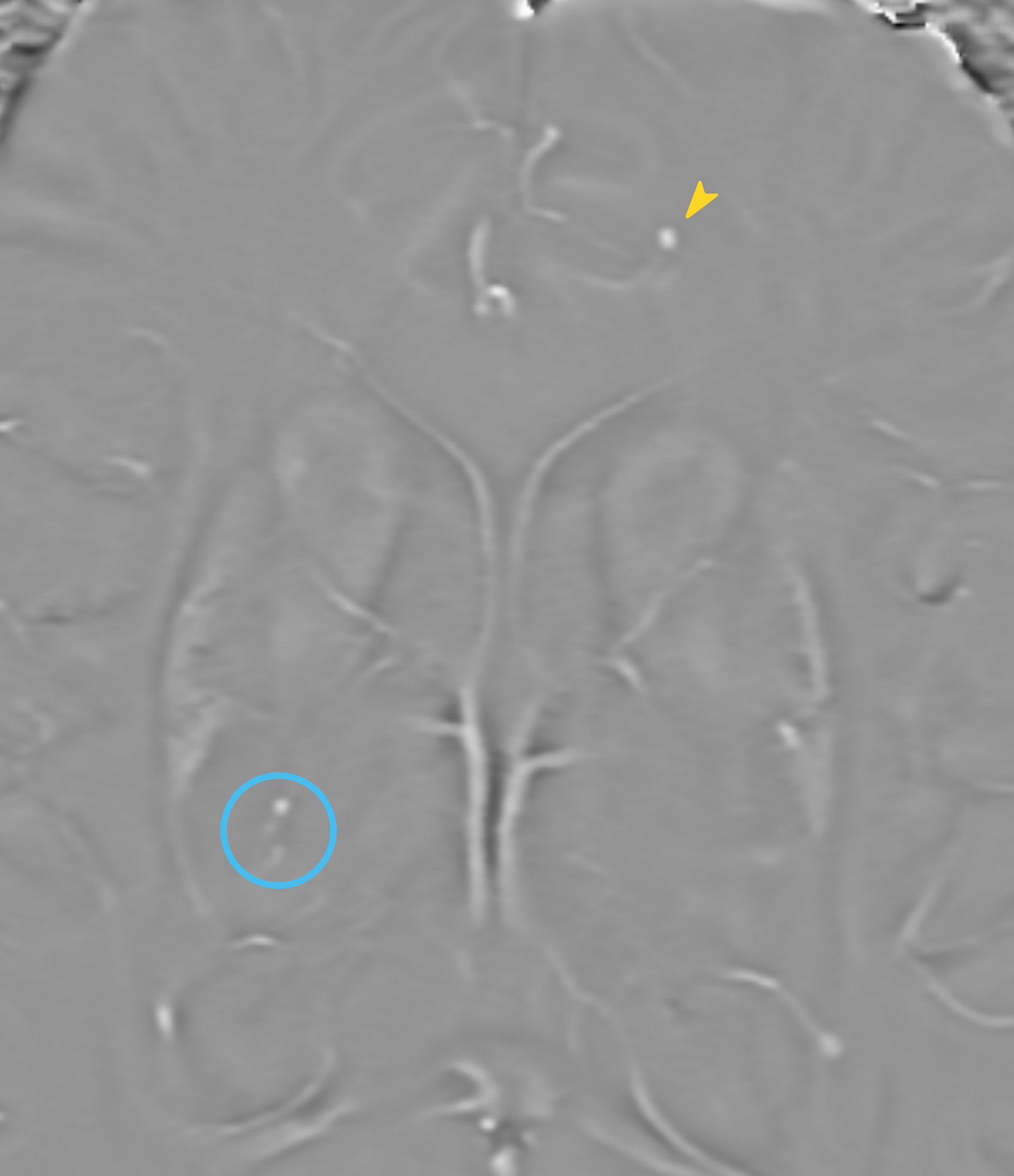 Right Image