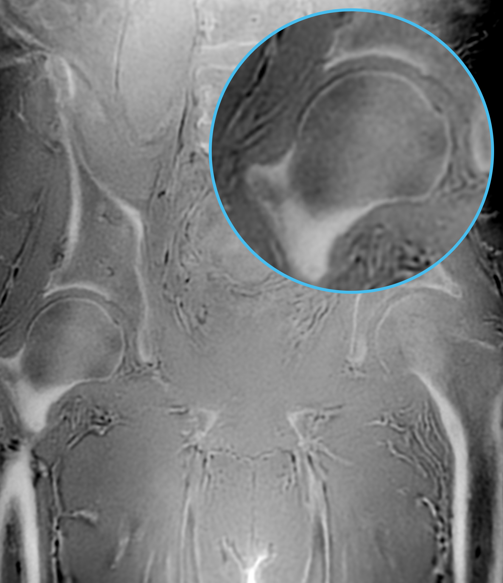 Right Image