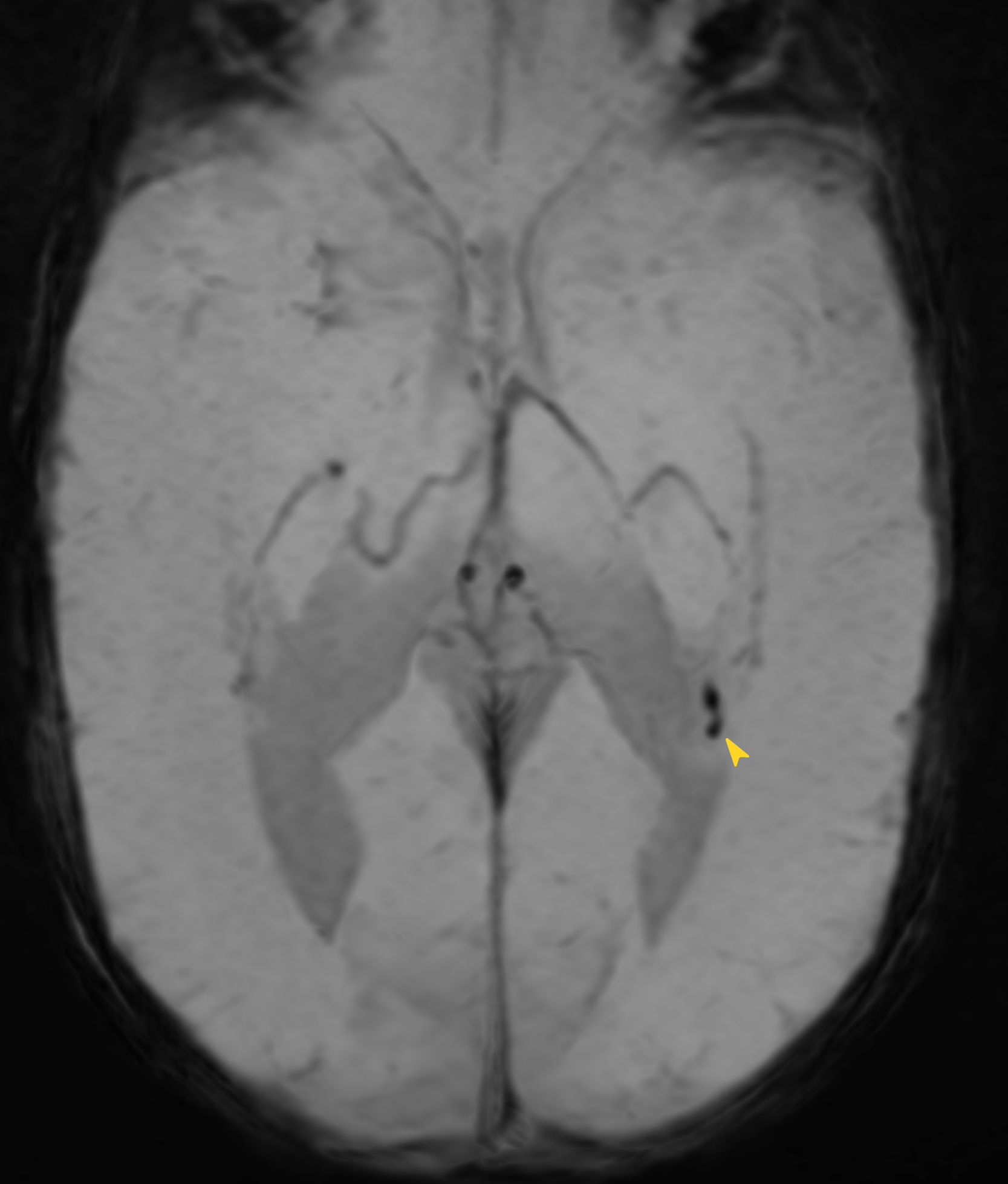 Right Image