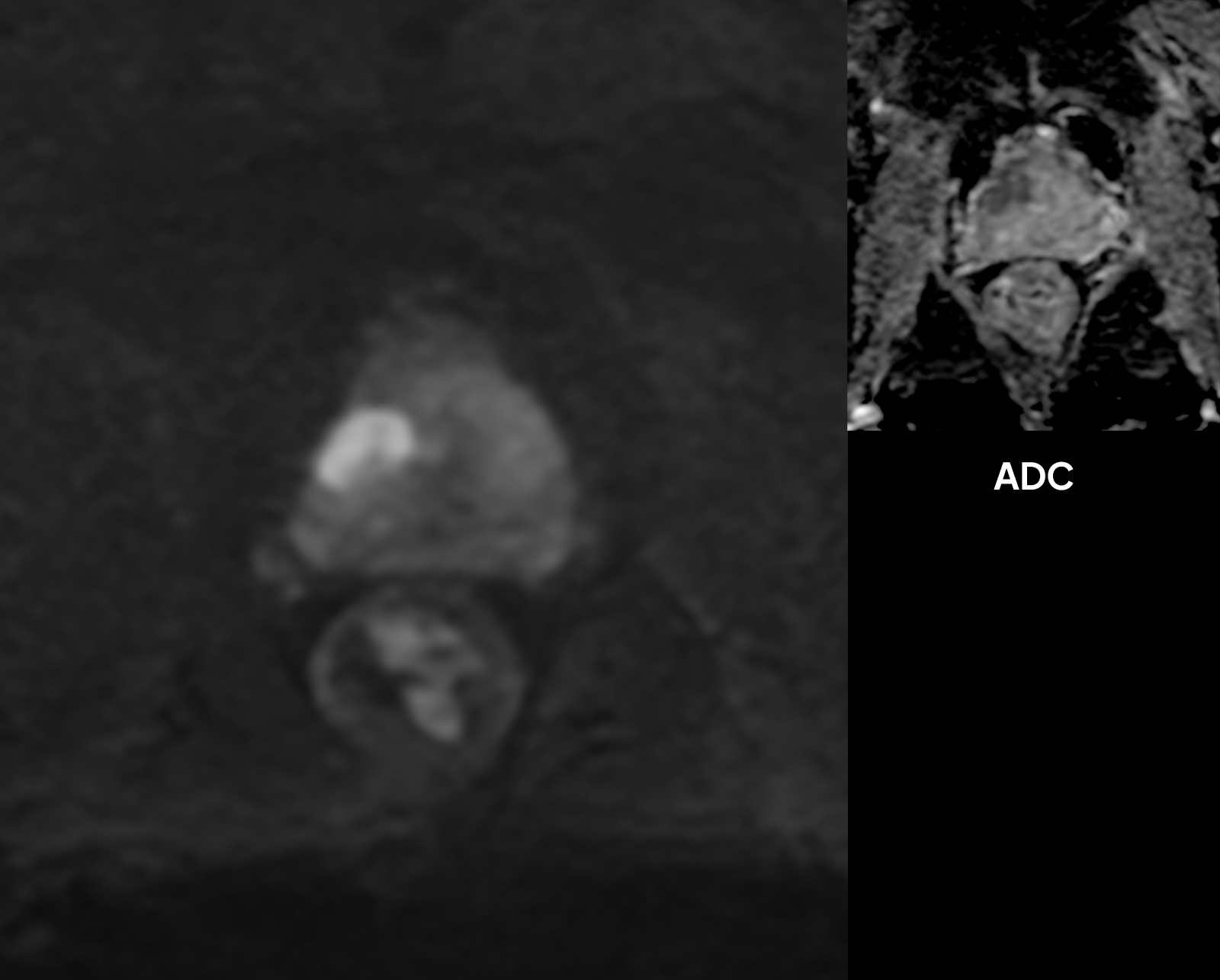 Right Image