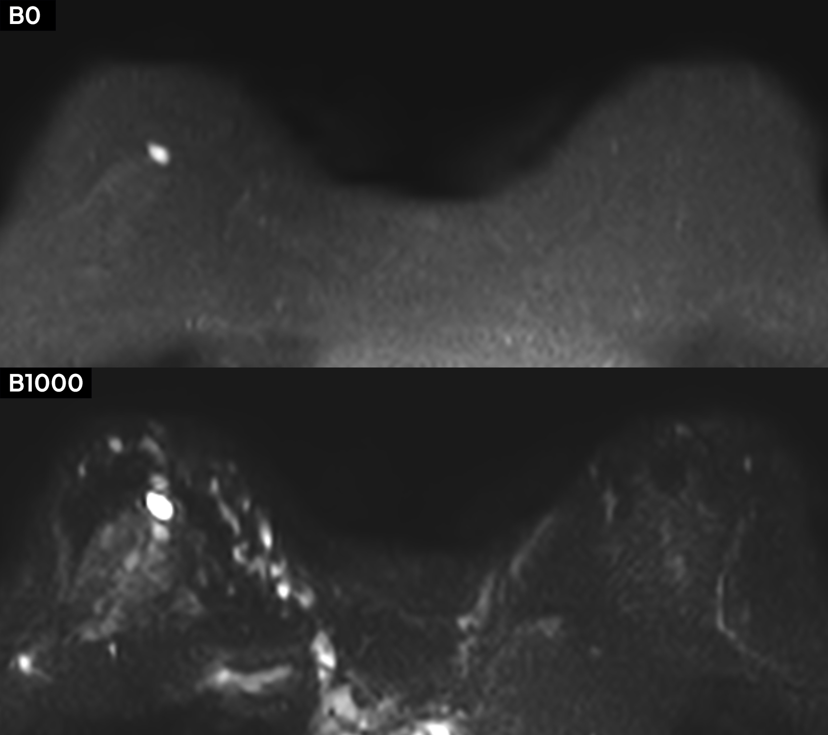 Right Image
