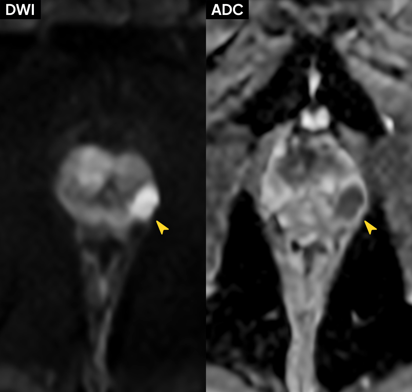 Right Image