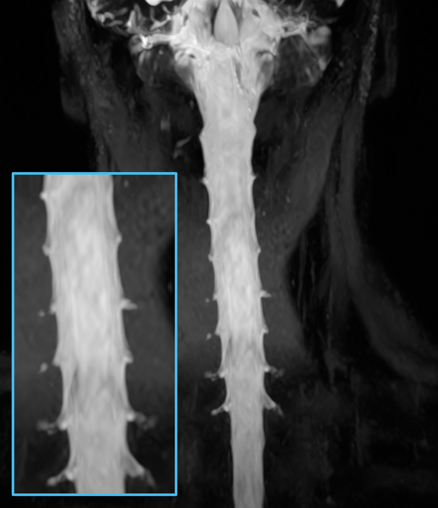 Right Image