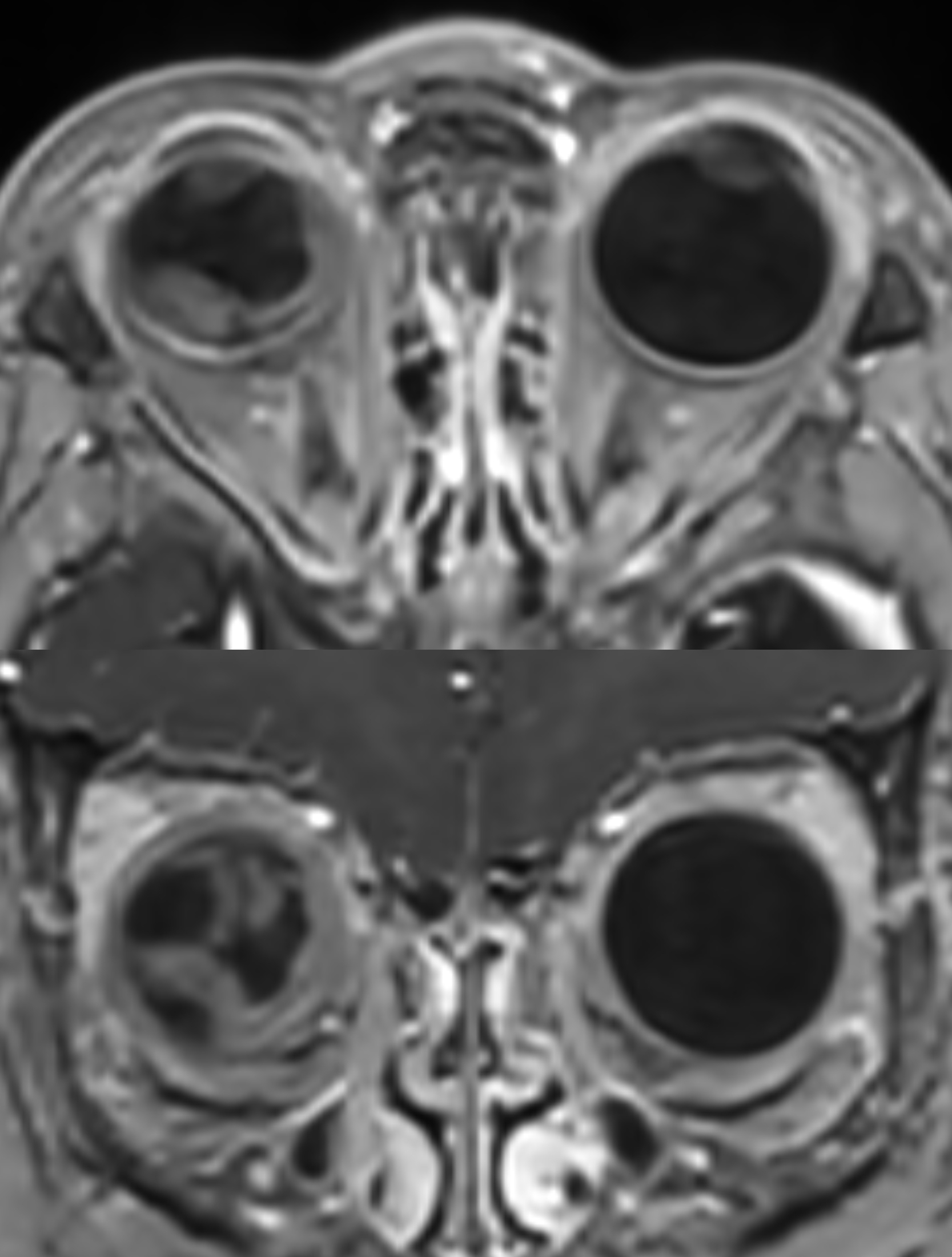 Right Image