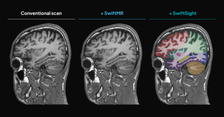 SwiftMR + SwiftSight Blog