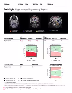 Hippocampal Asymmetry