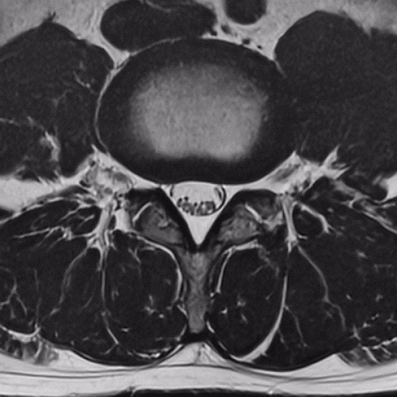 Accelerated + SwiftMR