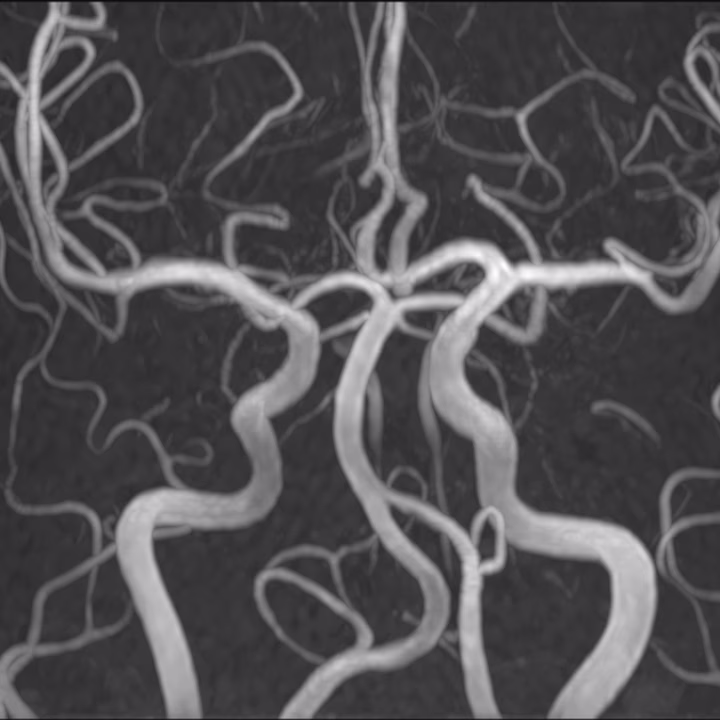BRAIN MRA — SwiftMR AI-enhanced scan