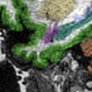 3.0T MRI brain scan — conventional processing, Scanner A