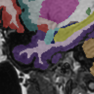 3.0T MRI brain scan — SwiftMR + SwiftSight enhanced, Scanner A