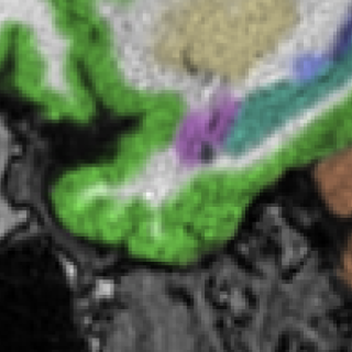 1.5T MRI brain scan — conventional processing, Scanner B