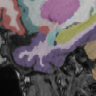 1.5T MRI brain scan — SwiftMR + SwiftSight enhanced, Scanner B