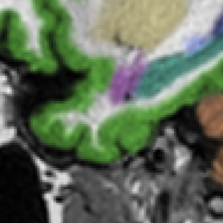 3.0T MRI brain scan — conventional processing, Scanner C