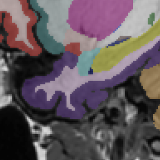 3.0T MRI brain scan — SwiftMR + SwiftSight enhanced, Scanner C