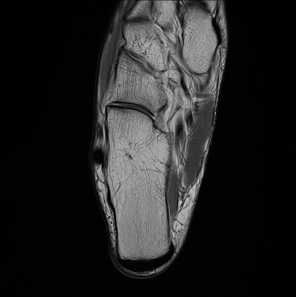 Ankle Ax PD — SwiftMR