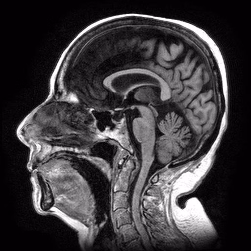 Brain Sagittal, Baseline