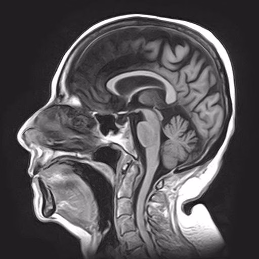Brain Sagittal, Conventional