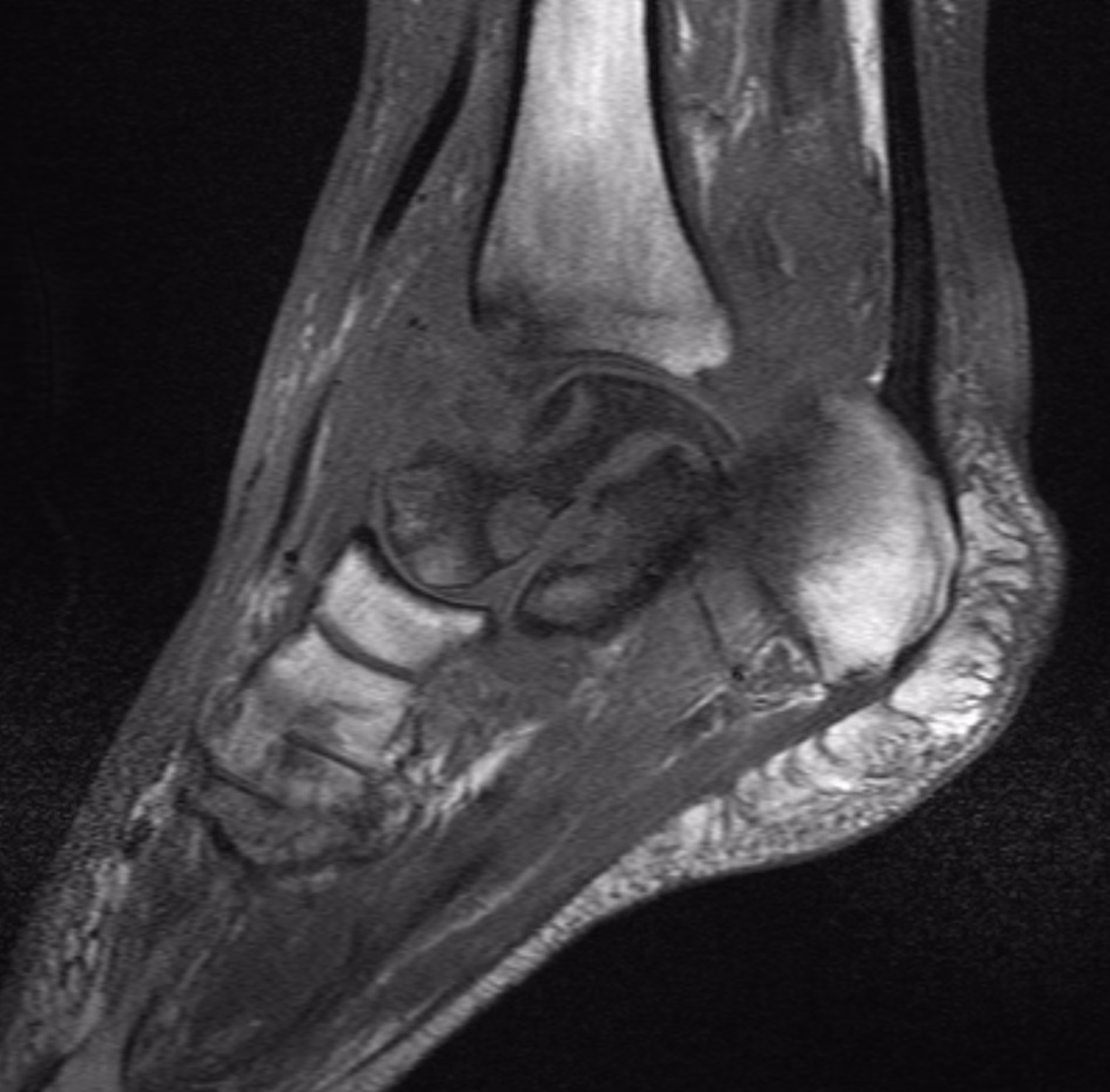 Scan times cut nearly in half — Symphony