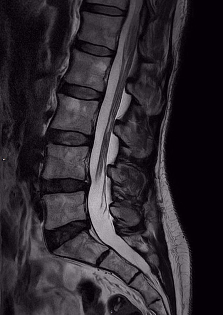 Spine — AiCE