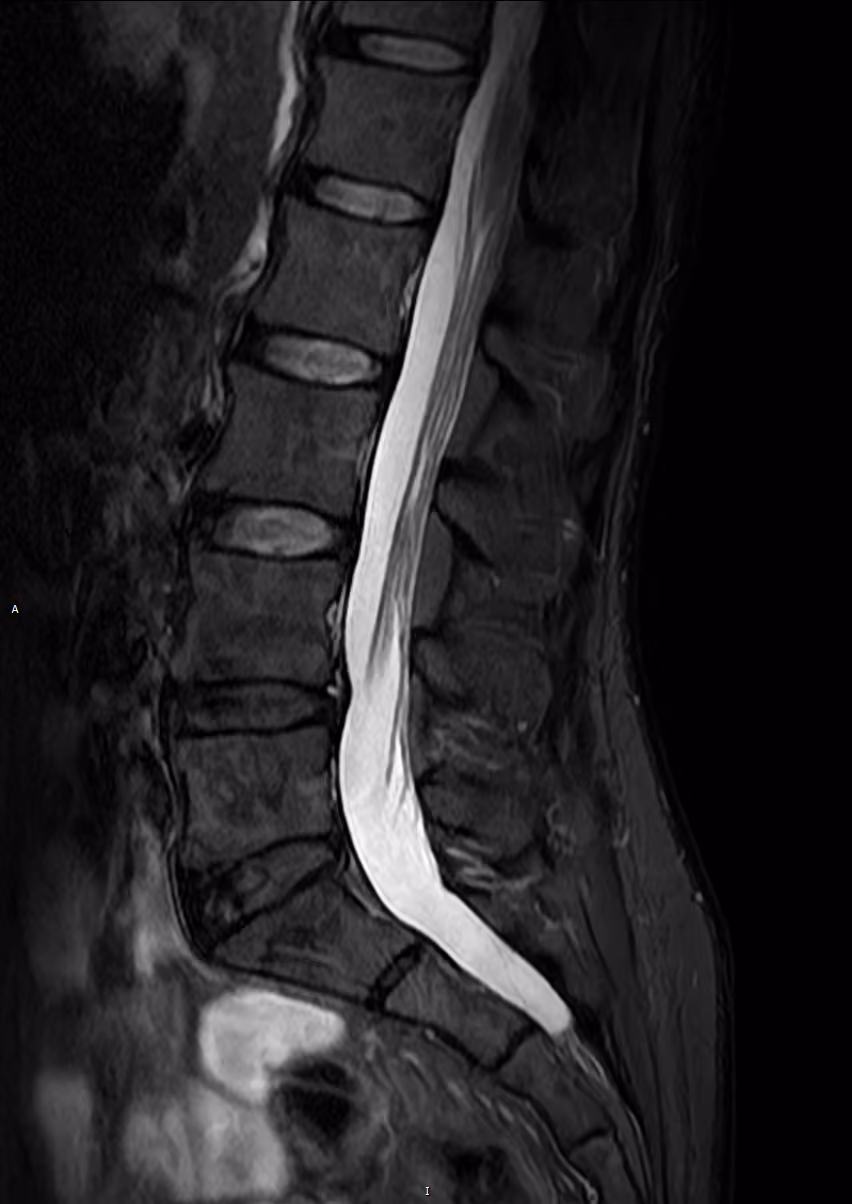 Spine — AiCE