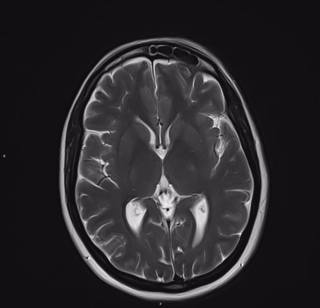Brain — Essenza + SwiftMR