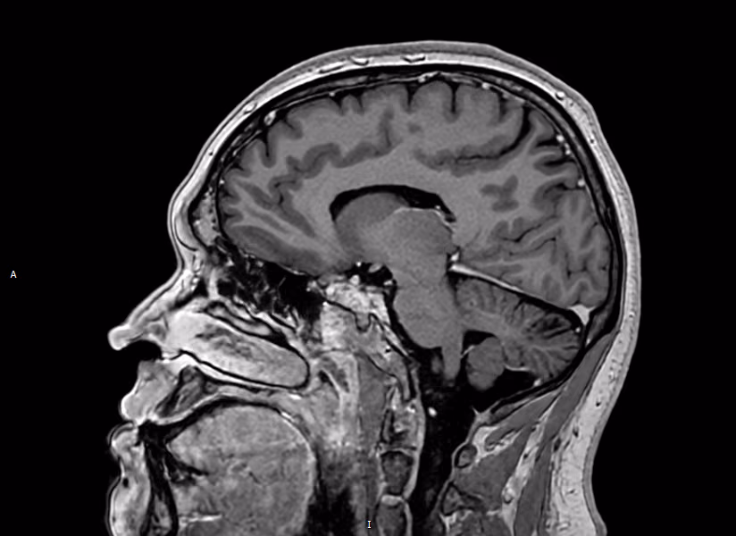 Brain — Accelerated + SwiftMR