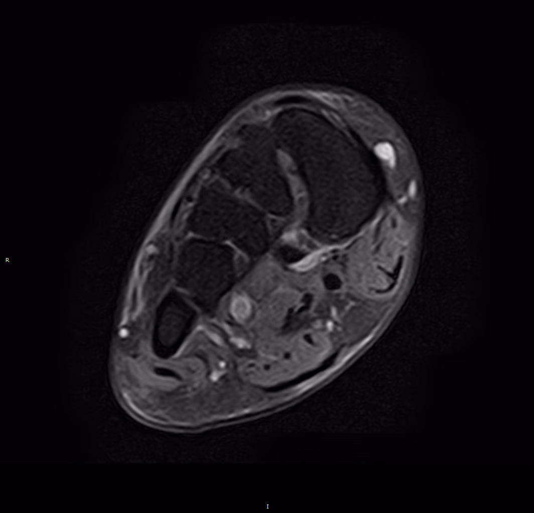 MSK — Conventional