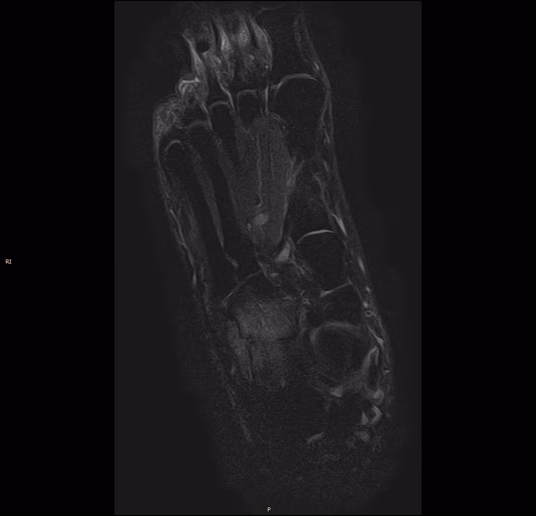 MSK — Conventional