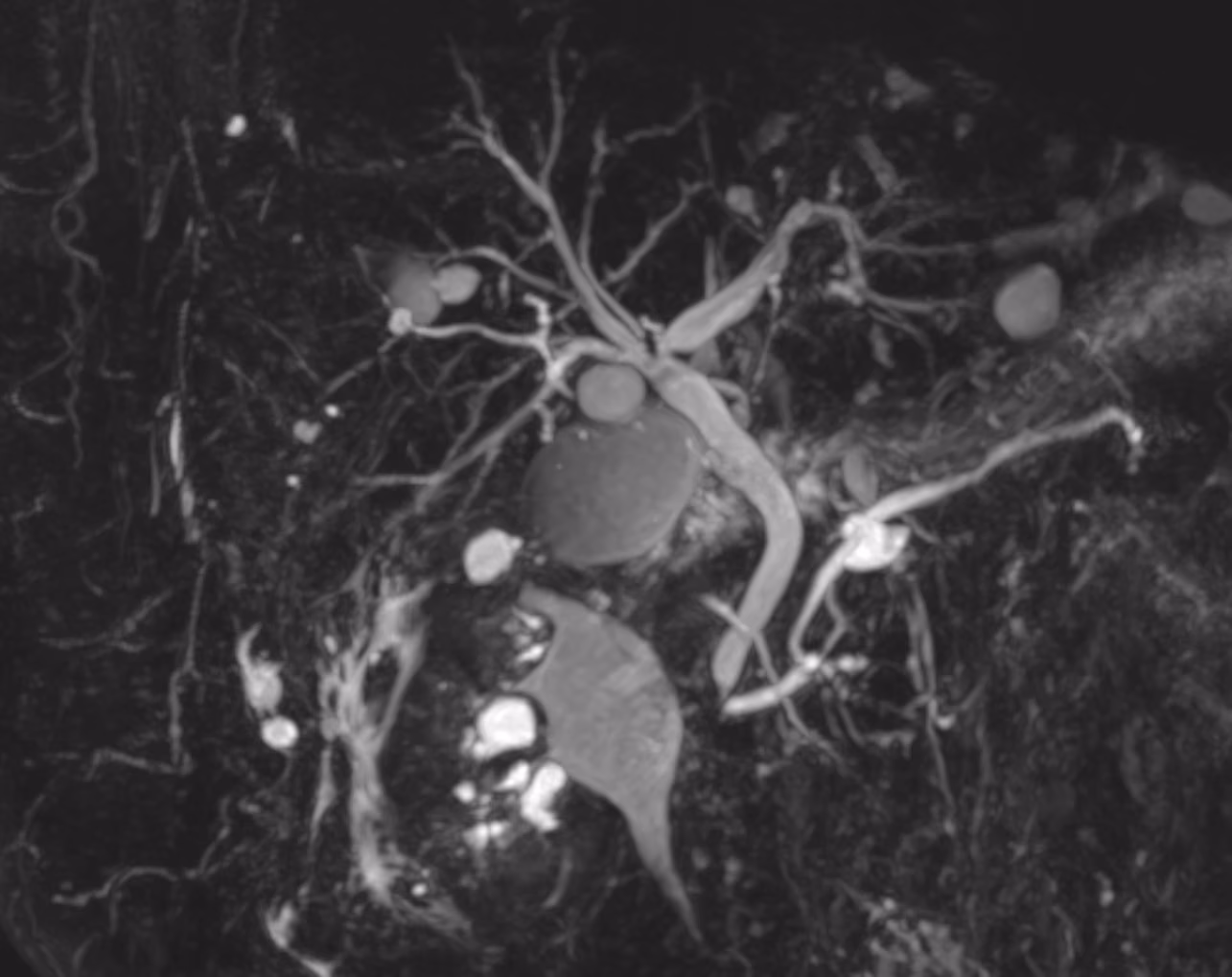 3D, vessels, and contrast-enhanced studies — Navigated 3D SPACE