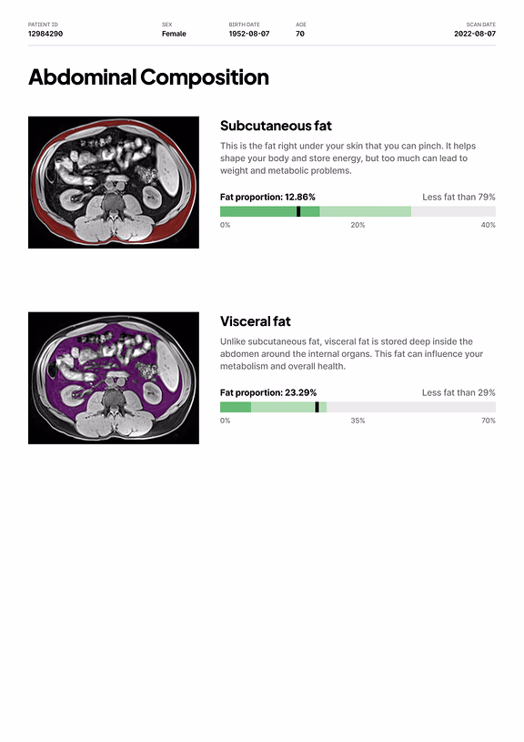 Report page: abdominal fat, with subcutaneous and visceral compartments segmented on MRI