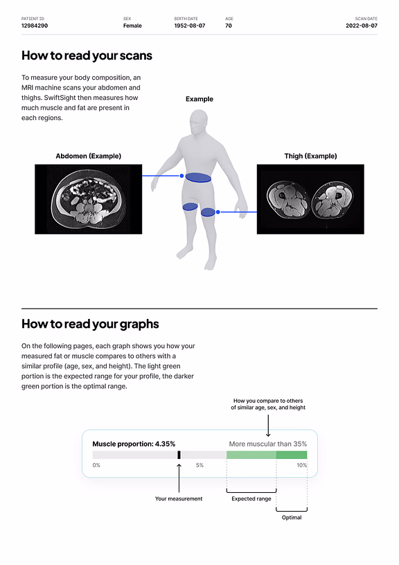 Report page: how to read the scans and the graphs, with an annotated example