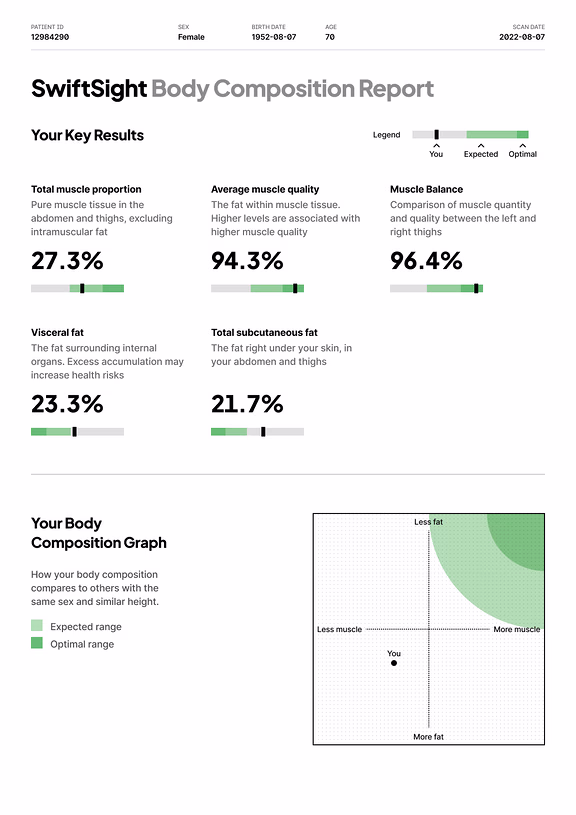 Report page: key results, with muscle proportion, muscle quality, balance and fat measures, and the body composition graph