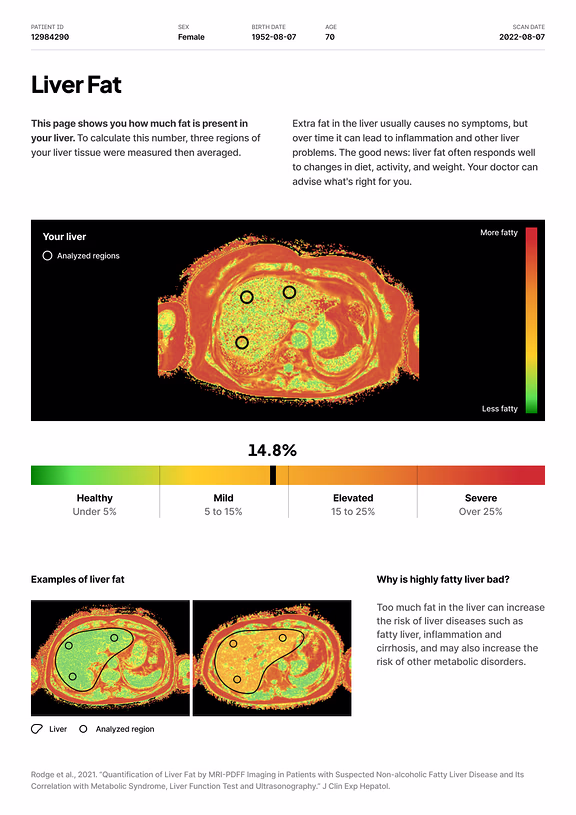 Report page: liver fat, with a proton density fat fraction map and a severity scale